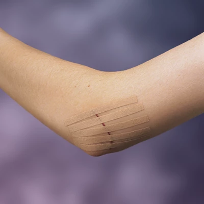 Sårförslutningsstrips Nexcare Steri-Strip 6mmx75mm